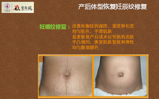 �ѳ��ޏ�(f��)